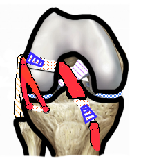 Opération genou ligament 1